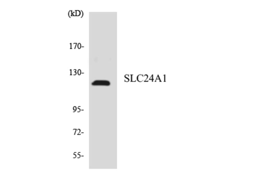 Western Blot - Anti-SLC24A1 Antibody (R12-3516) - Antibodies.com