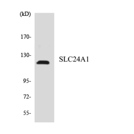 Western Blot - Anti-SLC24A1 Antibody (R12-3516) - Antibodies.com