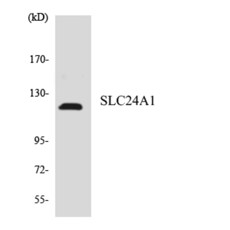 Western Blot - Anti-SLC24A1 Antibody (R12-3516) - Antibodies.com