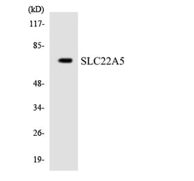 Western Blot - Anti-SLC22A5 Antibody (R12-3515) - Antibodies.com