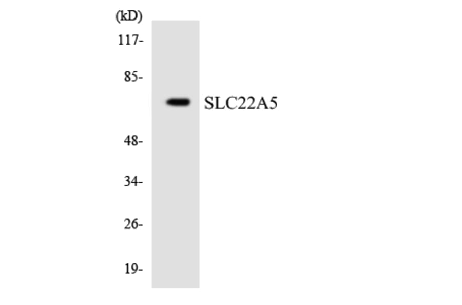 Western Blot - Anti-SLC22A5 Antibody (R12-3515) - Antibodies.com