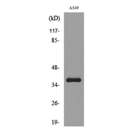 Western Blot - Anti-SLC10A1 Antibody (C30137) - Antibodies.com
