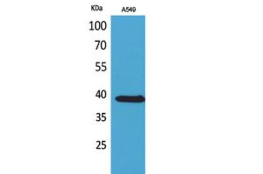 Western Blot - Anti-SLC10A1 Antibody (C30137) - Antibodies.com