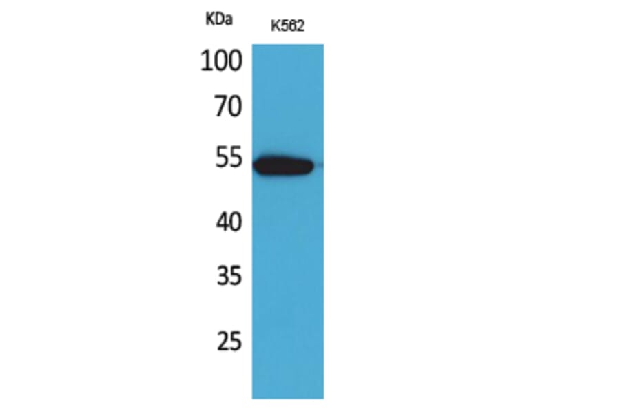 Western Blot - Anti-SIGLEC8 Antibody (C30515) - Antibodies.com