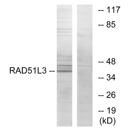 Western Blot - Anti-RAD51L3 Antibody (C13108) - Antibodies.com