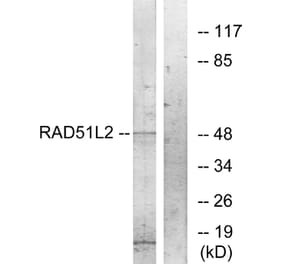Western Blot - Anti-RAD51L2 Antibody (C19668) - Antibodies.com