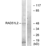 Western Blot - Anti-RAD51L2 Antibody (C19668) - Antibodies.com