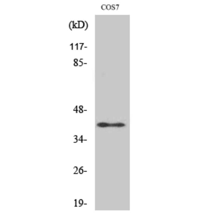 Western Blot - Anti-RAD51L2 Antibody (C19668) - Antibodies.com
