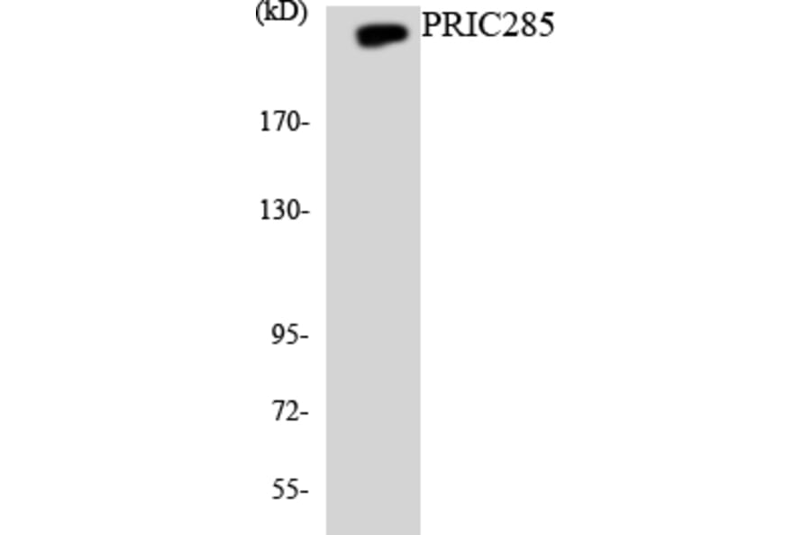Western Blot - Anti-PRIC285 Antibody (R12-3360) - Antibodies.com