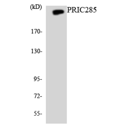 Western Blot - Anti-PRIC285 Antibody (R12-3360) - Antibodies.com