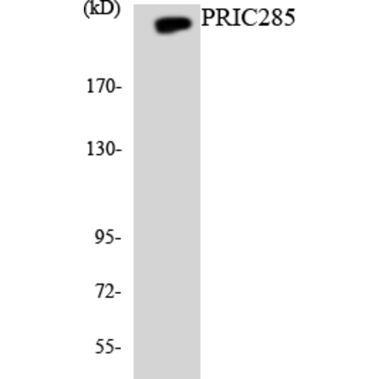 Western Blot - Anti-PRIC285 Antibody (R12-3360) - Antibodies.com