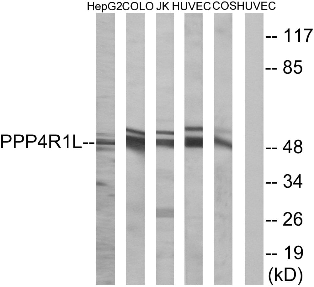 Western blot analysis of lysates from COLO, HUVEC, HepG Jurkat, and COS cells using Anti-PPP4R1L Antibody. The right hand lane represents a negative control, where the antibody is blocked by the immunising peptide.