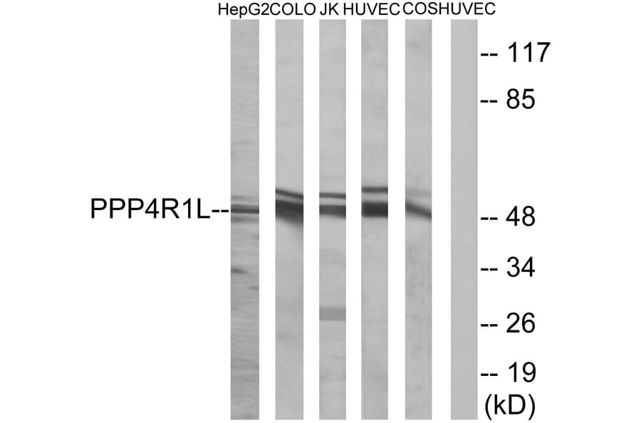 Western Blot - Anti-PPP4R1L Antibody (C18661) - Antibodies.com