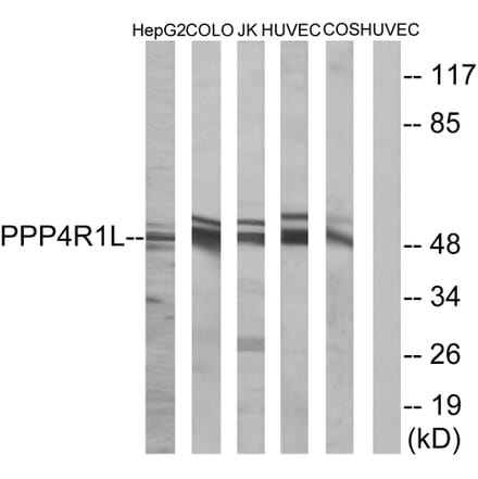 Western Blot - Anti-PPP4R1L Antibody (C18661) - Antibodies.com