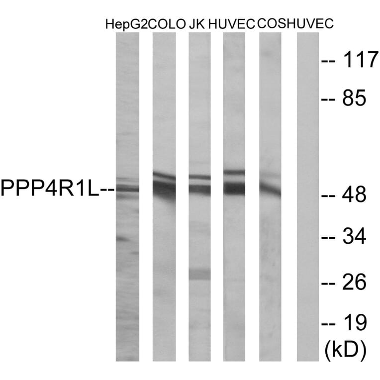 Western Blot - Anti-PPP4R1L Antibody (C18661) - Antibodies.com