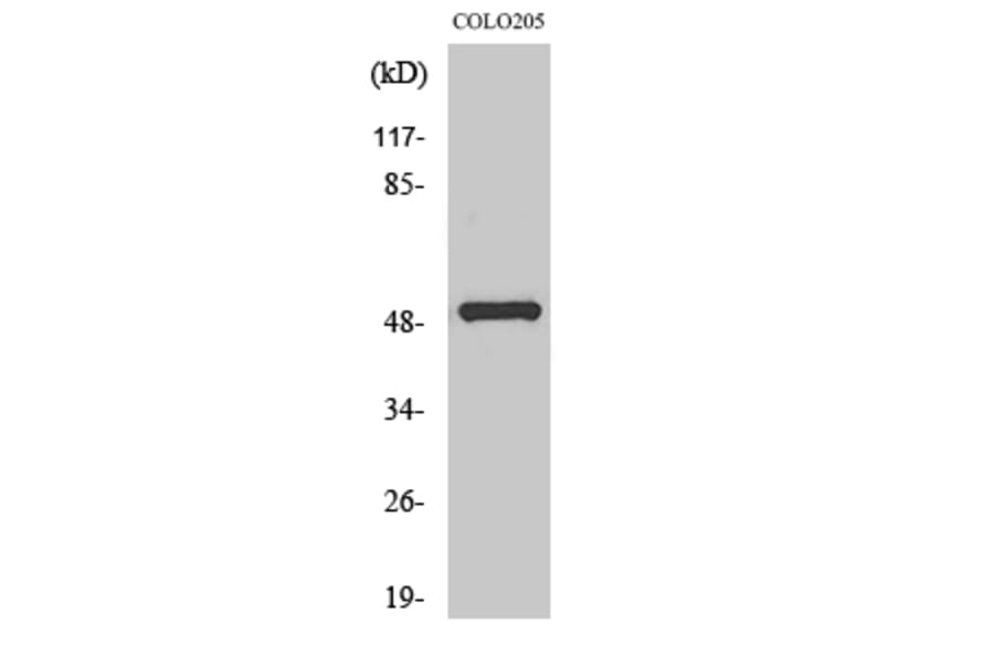 Western Blot - Anti-PPP4R1L Antibody (C18661) - Antibodies.com