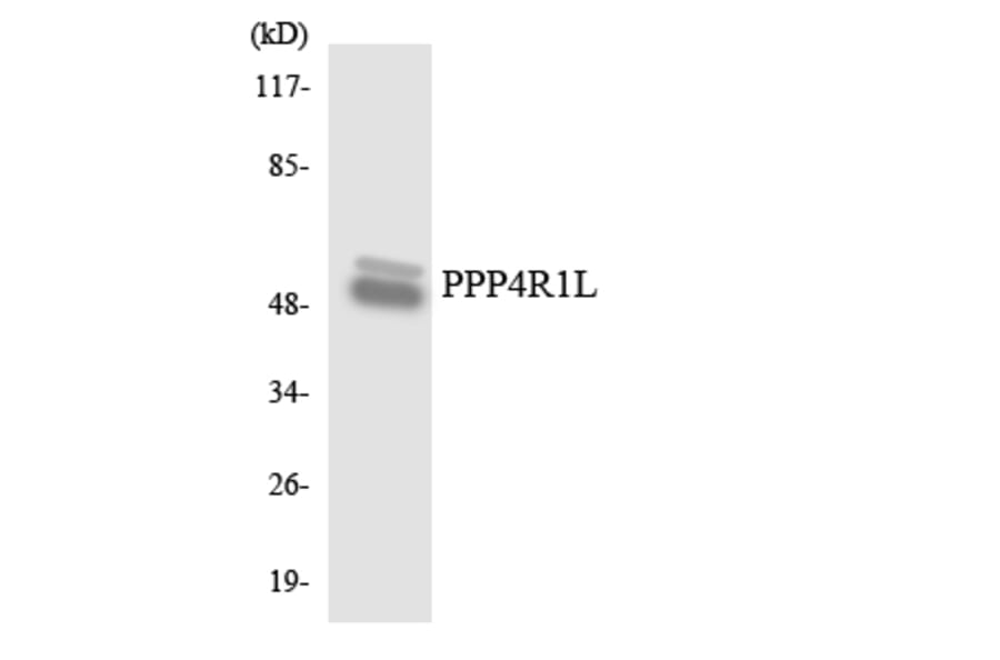 Western Blot - Anti-PPP4R1L Antibody (R12-3358) - Antibodies.com