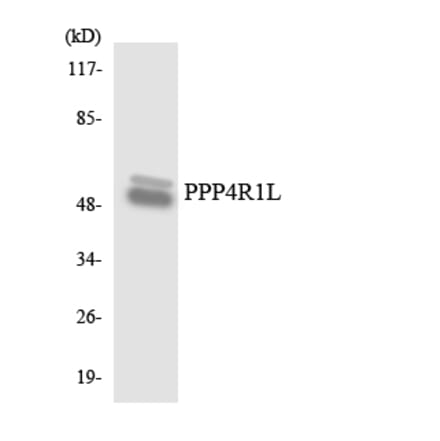 Western Blot - Anti-PPP4R1L Antibody (R12-3358) - Antibodies.com