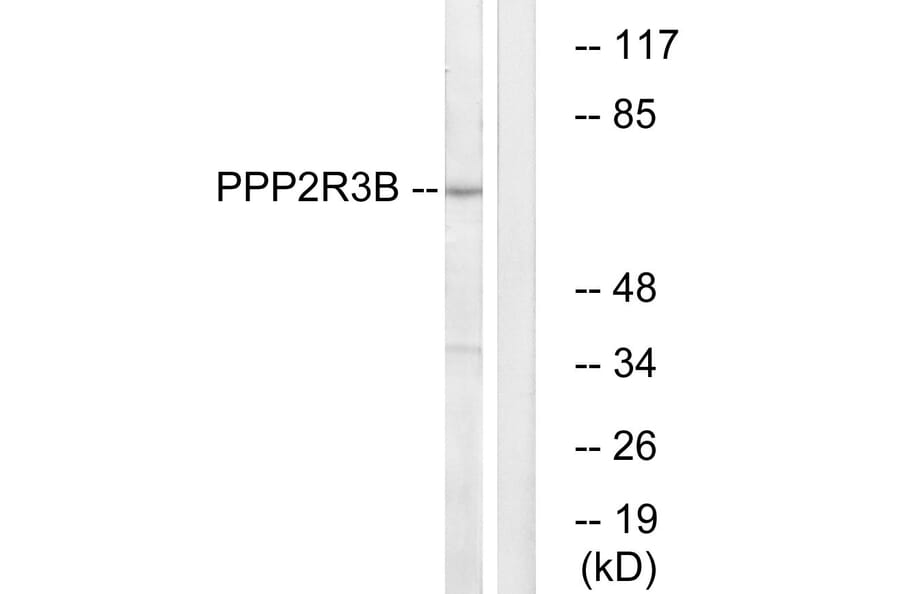 Western Blot - Anti-PPP2R3B Antibody (C18654) - Antibodies.com