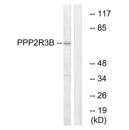 Western Blot - Anti-PPP2R3B Antibody (C18654) - Antibodies.com