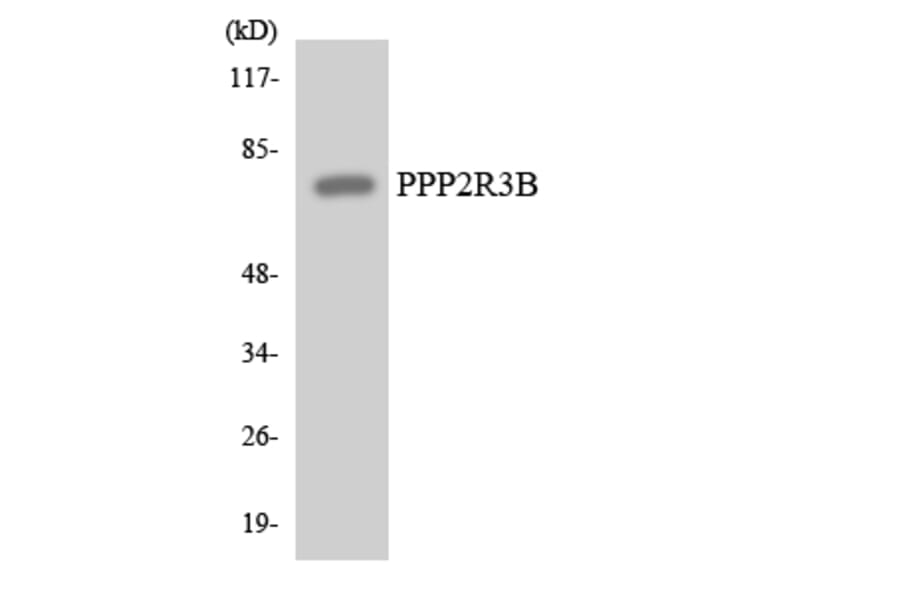 Western Blot - Anti-PPP2R3B Antibody (R12-3354) - Antibodies.com