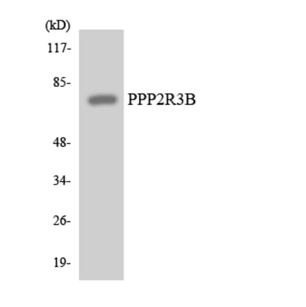 Western Blot - Anti-PPP2R3B Antibody (R12-3354) - Antibodies.com
