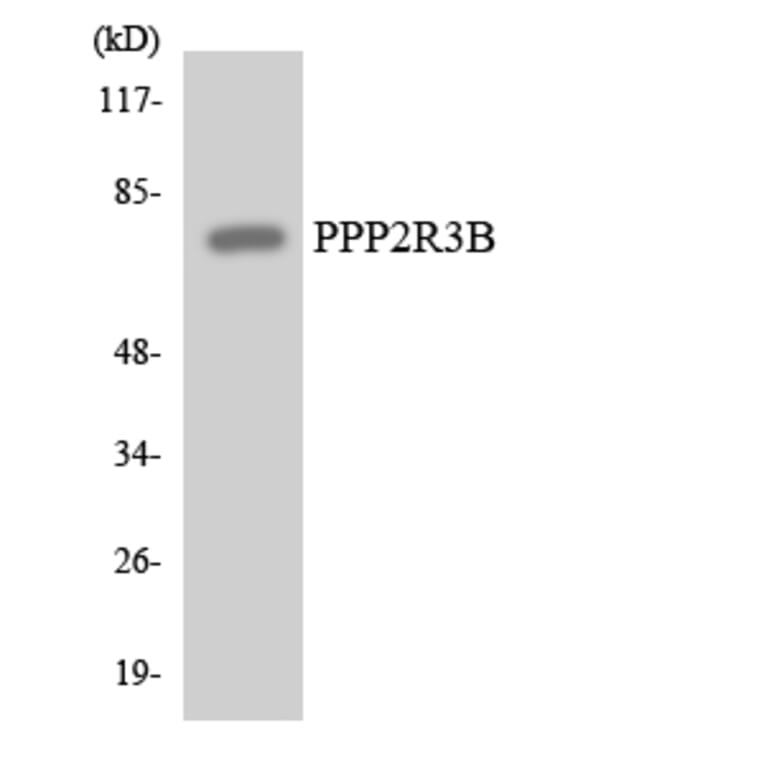 Western Blot - Anti-PPP2R3B Antibody (R12-3354) - Antibodies.com