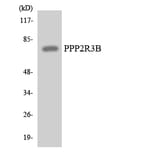 Western Blot - Anti-PPP2R3B Antibody (R12-3354) - Antibodies.com