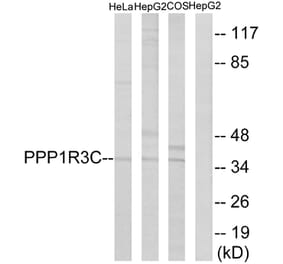 Western Blot - Anti-PPP1R3C Antibody (C18015) - Antibodies.com