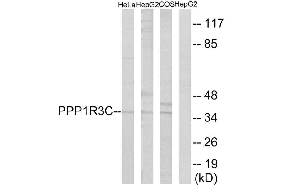 Western Blot - Anti-PPP1R3C Antibody (C18015) - Antibodies.com