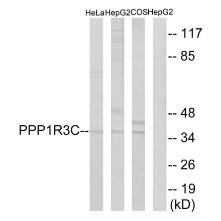 Western Blot - Anti-PPP1R3C Antibody (C18015) - Antibodies.com
