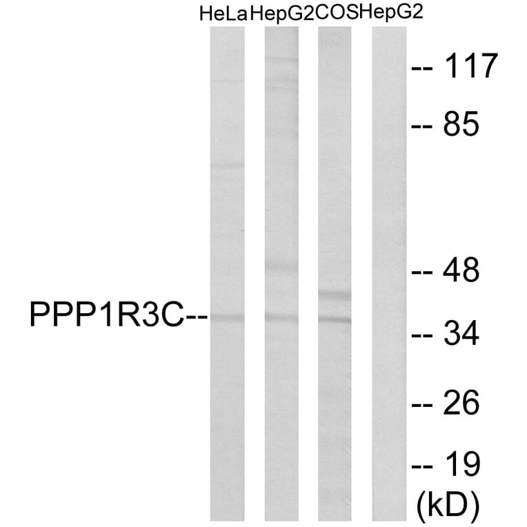 Western Blot - Anti-PPP1R3C Antibody (C18015) - Antibodies.com