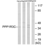 Western Blot - Anti-PPP1R3C Antibody (C18015) - Antibodies.com