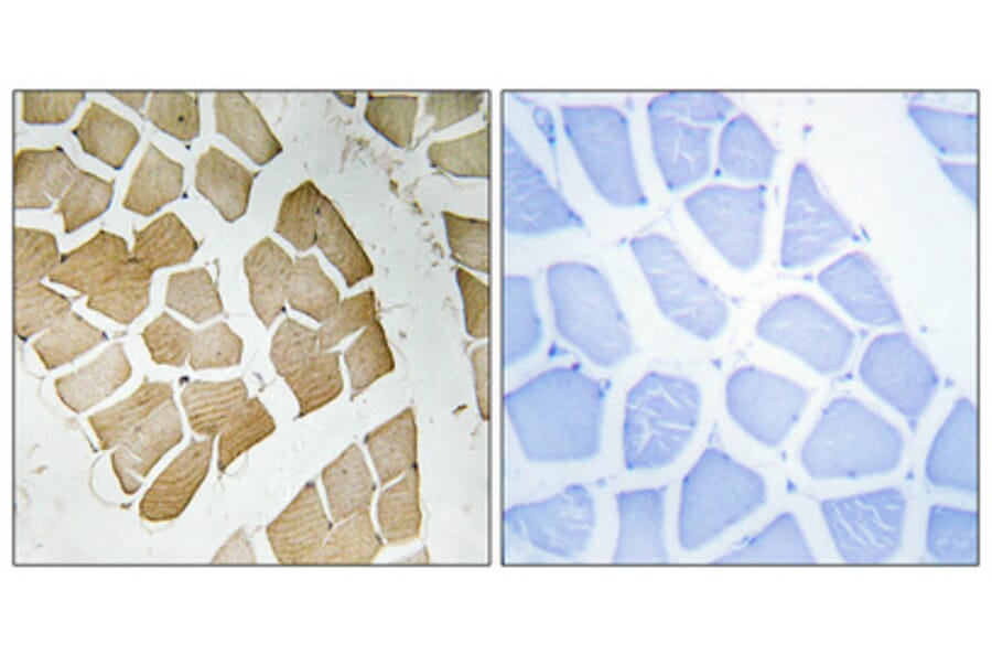 Immunohistochemistry - Anti-PPP1R3C Antibody (C18015) - Antibodies.com