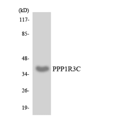 Western Blot - Anti-PPP1R3C Antibody (R12-3350) - Antibodies.com
