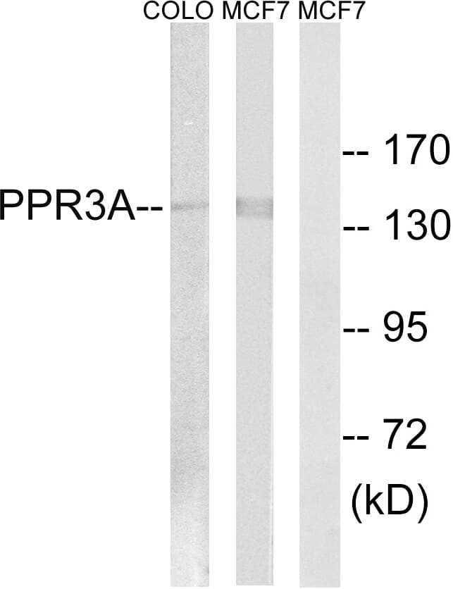 Western blot analysis of lysates from MCF-7 and COLO cells using Anti-PPP1R3A Antibody. The right hand lane represents a negative control, where the antibody is blocked by the immunising peptide.