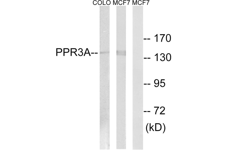 Western Blot - Anti-PPP1R3A Antibody (C18014) - Antibodies.com