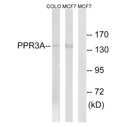 Western Blot - Anti-PPP1R3A Antibody (C18014) - Antibodies.com