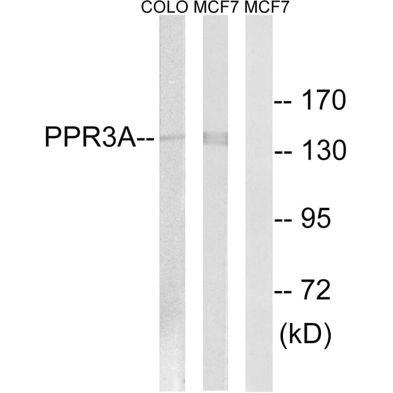 Western Blot - Anti-PPP1R3A Antibody (C18014) - Antibodies.com