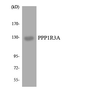 Western blot analysis of the lysates from HT 29 cells using Anti-PPP1R3A Antibody.