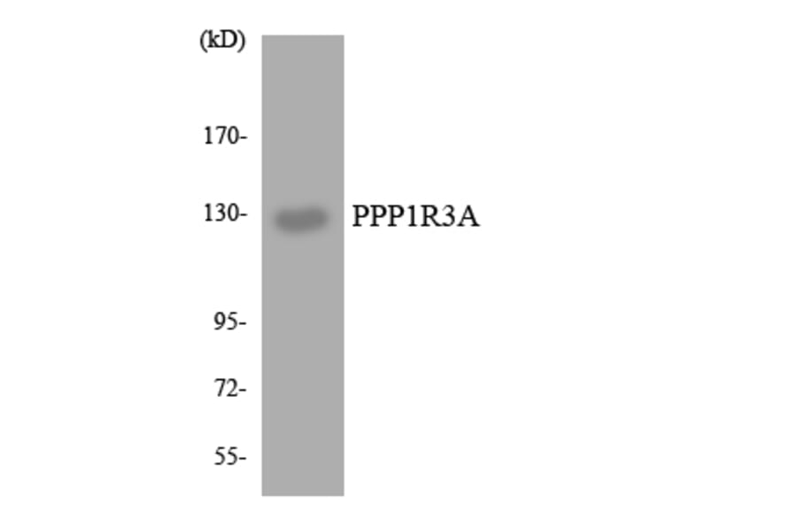 Western Blot - Anti-PPP1R3A Antibody (R12-3349) - Antibodies.com
