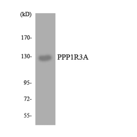 Western Blot - Anti-PPP1R3A Antibody (R12-3349) - Antibodies.com