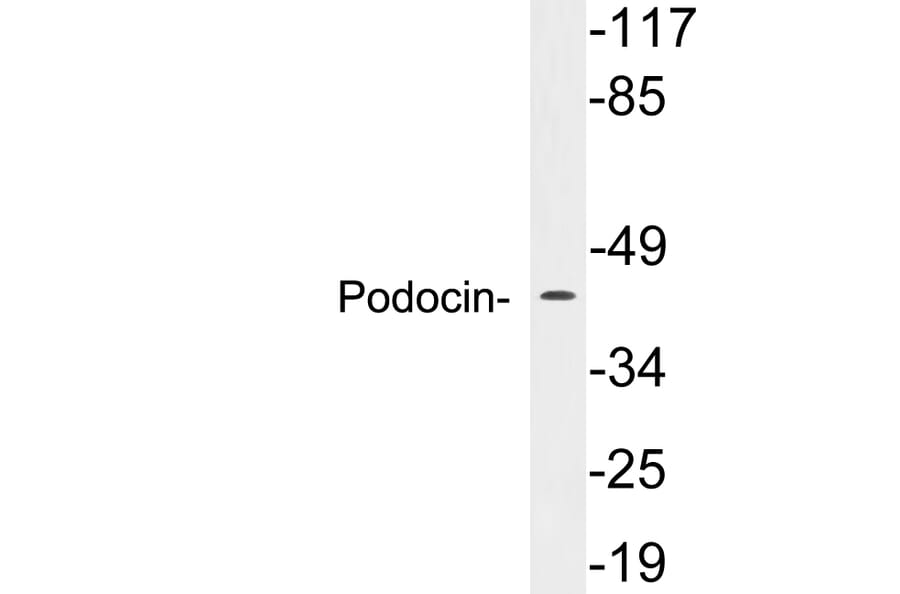 Western Blot - Anti-Podocin Antibody (R12-2314) - Antibodies.com