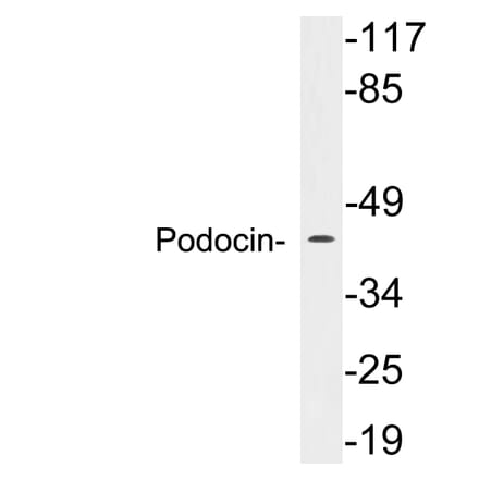 Western Blot - Anti-Podocin Antibody (R12-2314) - Antibodies.com