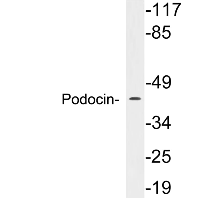 Western Blot - Anti-Podocin Antibody (R12-2314) - Antibodies.com