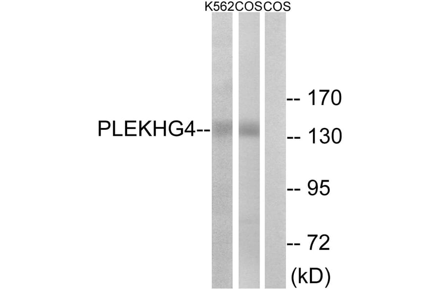 Western Blot - Anti-PLEKHG4 Antibody (C18077) - Antibodies.com