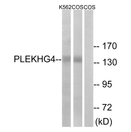 Western Blot - Anti-PLEKHG4 Antibody (C18077) - Antibodies.com