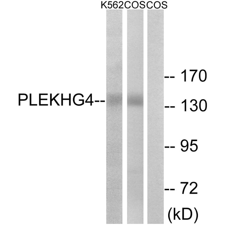 Western Blot - Anti-PLEKHG4 Antibody (C18077) - Antibodies.com
