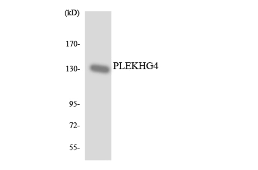 Western Blot - Anti-PLEKHG4 Antibody (R12-3336) - Antibodies.com