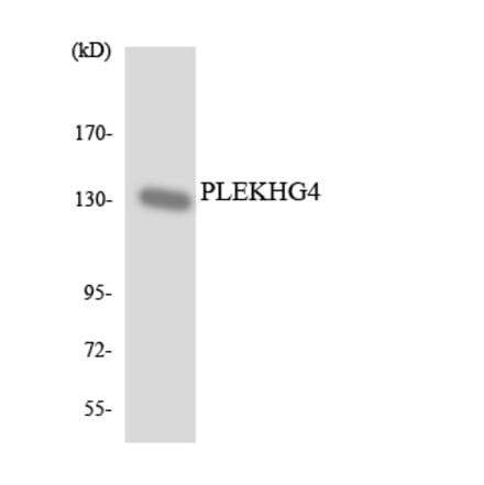 Western Blot - Anti-PLEKHG4 Antibody (R12-3336) - Antibodies.com